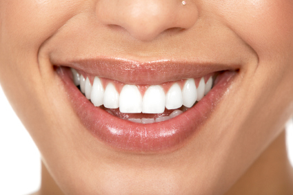 White Teeth